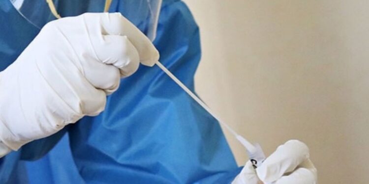 La Comisión propone medidas para mejorar la disponibilidad de diagnósticos in vitro