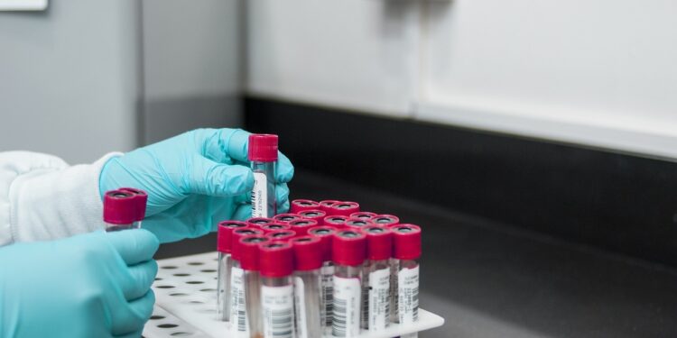 La UE reforzará la seguridad de los pacientes sometidos a transfusiones de sangre, trasplantes y fertilización in vitro