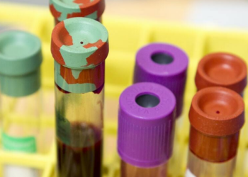 La EMA certifica por primera vez plasma procedente de África y Oriente Medio para fabricar hemoderivados en la UE